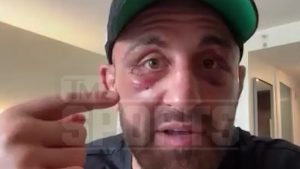 EXCLUSIVO: Alex Volkanovski Revela Ambição CHOCA! Após Vitória no UFC 314, Ele Quer o 2º Título!