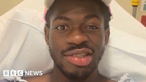 Lil Nas X em estado crítico: Paralisia facial chocante!