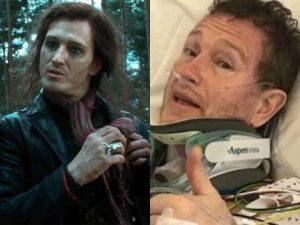 Alerta! Ator de ‘Harry Potter’ à Beira do Abismo: Pode Perder Movimento e Fala Após Cirurgia!