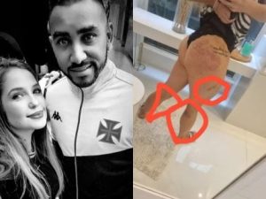 Explosivo: Advogada Deixa o Mundo Em Choque Com Lesões Após Acusar Payet de Brutal Agressão!