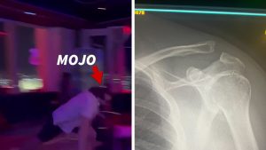 Chocante! Mojo Muhtadi Desafia a Morte com Lesão Brutal no Ombro em Dança de Vegas!