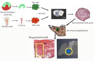 Por que os humanos não conseguem regrow seus dentes? A chocante descoberta sobre os porcos que pode revolucionar a medicina!