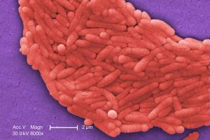 Como a Salmonella Desafia a Morte: Segredos Surpreendentes de Sobrevivência em Ambientes Hostis!